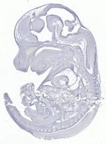 EMAGE:29631