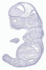 EMAGE:29631