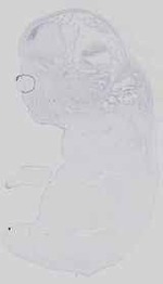 EMAGE:29648