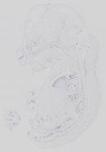 EMAGE:29662