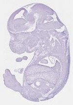EMAGE:29664