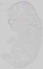 EMAGE:29672