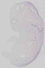 EMAGE:29672