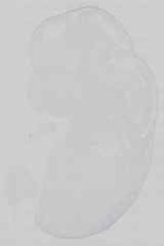 EMAGE:29672