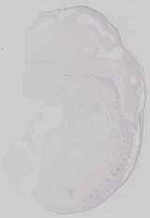 EMAGE:29672