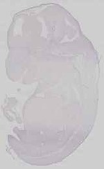 EMAGE:29672