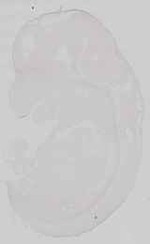 EMAGE:29672