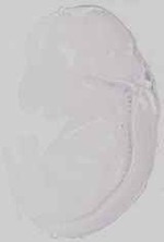 EMAGE:29672