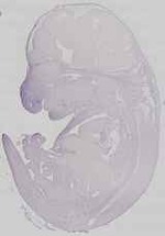 EMAGE:29672