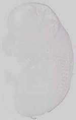 EMAGE:29672