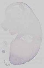 EMAGE:29672