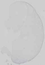 EMAGE:29672