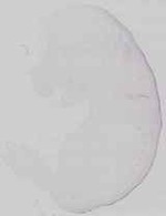 EMAGE:29672