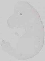 EMAGE:29672
