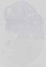 EMAGE:29678