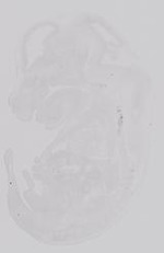 EMAGE:29691
