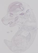 EMAGE:29712