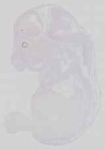 EMAGE:29732