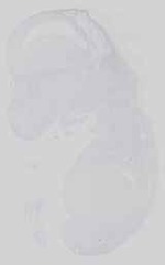 EMAGE:29733