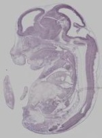 EMAGE:29747