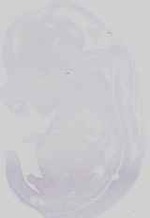 EMAGE:29757