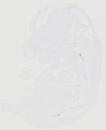 EMAGE:29760