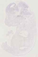 EMAGE:29762