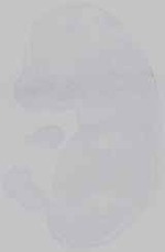 EMAGE:29772