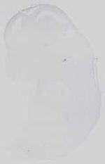EMAGE:29781