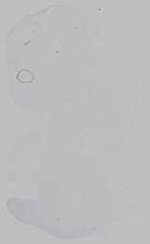 EMAGE:29794