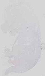 EMAGE:29832