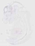 EMAGE:29853