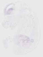 EMAGE:29853