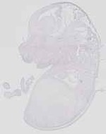 EMAGE:29854
