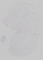 EMAGE:29860