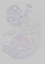 EMAGE:29862
