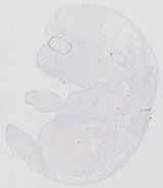 EMAGE:29872