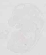 EMAGE:29872