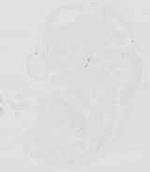 EMAGE:29872