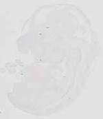 EMAGE:29872