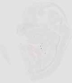 EMAGE:29872