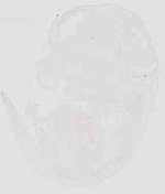 EMAGE:29872