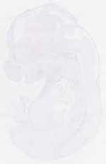 EMAGE:29873