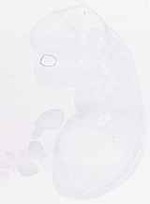 EMAGE:29873