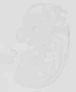 EMAGE:29875