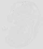 EMAGE:29875