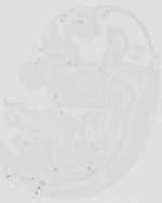 EMAGE:29875
