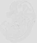 EMAGE:29875