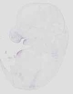 EMAGE:29875
