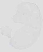 EMAGE:29875